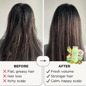 Matcha Shake Shampoo Concentrate | For All Hair Types thumbnail-image-4